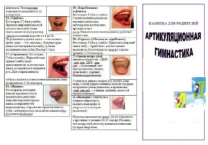Артикуляционная гимнастика для звука "Л" (буклет)